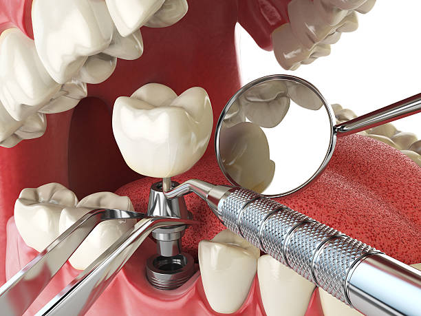 Best Emergency Dental Surgery in USA